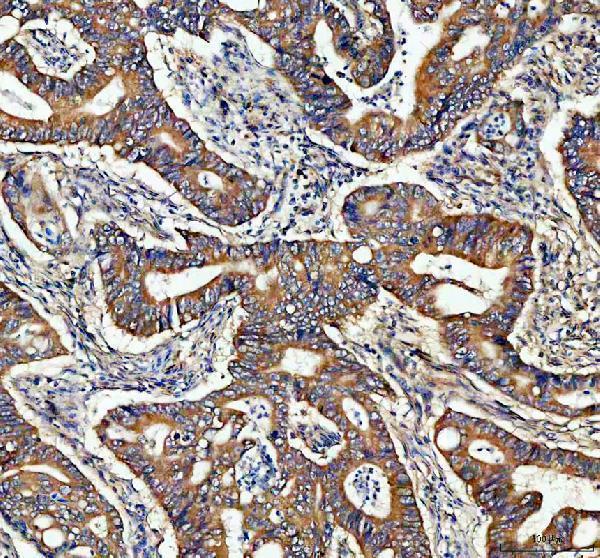 m00566 adam10 primary antibodies ihc testing 1