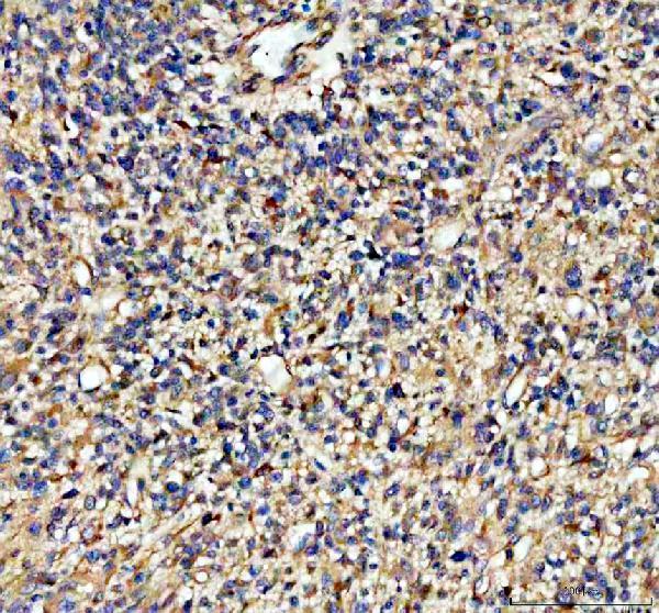 m00566 adam10 primary antibodies ihc testing 2