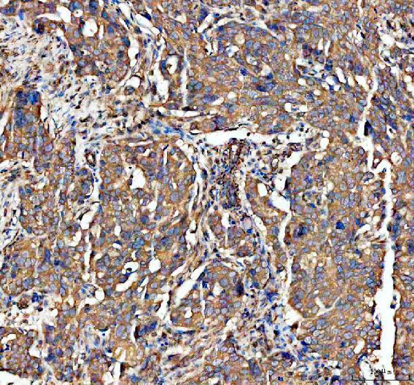 m00566 adam10 primary antibodies ihc testing 3