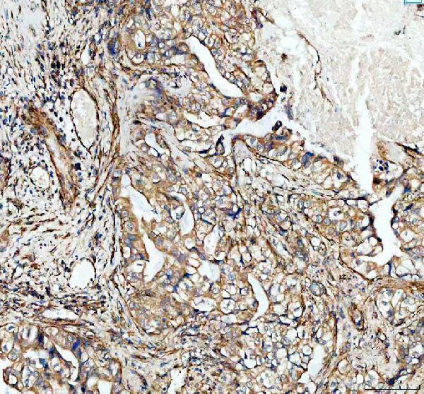 m00566 adam10 primary antibodies ihc testing 4