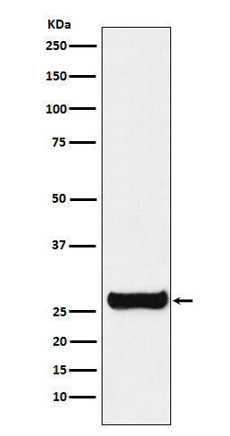 Western blot analysis of GSTM1 expression in SH-SY5Y cell lysate