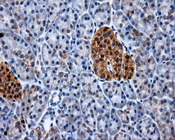 m00571 1 anti xrcc1 mouse monoclonal antibody clone id oti2d8 ihc testing 4