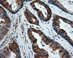 m00571 1 anti xrcc1 mouse monoclonal antibody clone id oti2d8 ihc testing 7