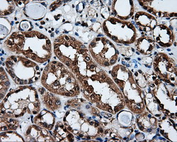 m00571 1 anti xrcc1 mouse monoclonal antibody clone id oti2d8 ihc testing 8