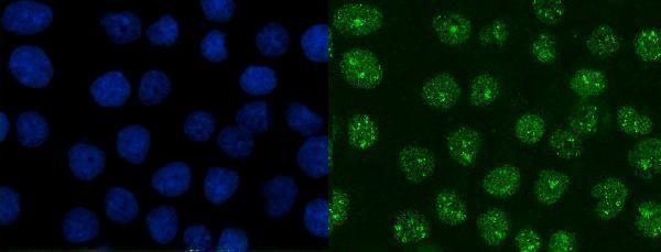  IF analysis of XRCC1 using anti-XRCC1 antibody (M00571-2)