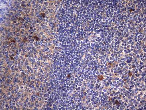 m00573 anti c2 mouse monoclonal antibody clone id oti12g10 ihc testing 3