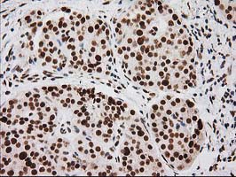 m00575 1 anti lox mouse monoclonal antibody clone id oti9g2 ihc testing 5