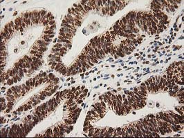 m00575 1 anti lox mouse monoclonal antibody clone id oti9g2 ihc testing 8