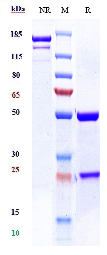 Anti-TSHR Reference Antibody (K1-70) on SDS-PAGE under reducing (R) condition