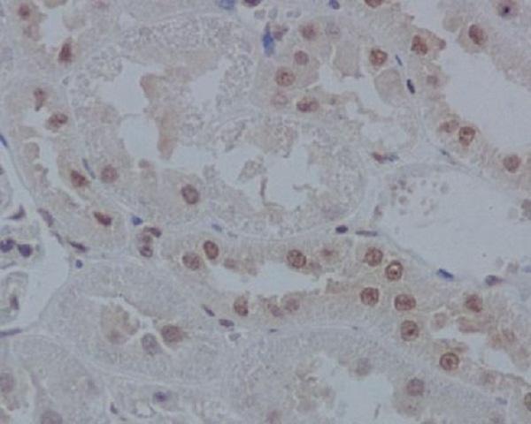 Immunohistochemical analysis of paraffin-embedded rat kidney, using IRF1 Antibody