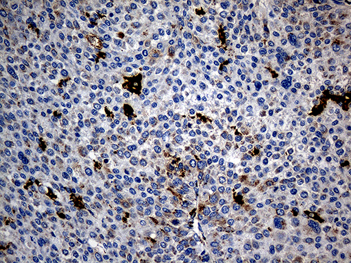 m00581 anti ptpn22 mouse monoclonal antibody clone id oti6b1 ihc testing 13