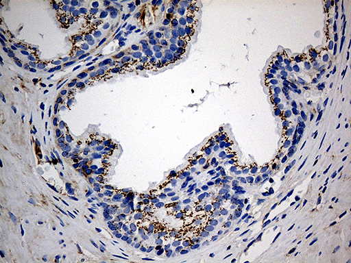 m00581 anti ptpn22 mouse monoclonal antibody clone id oti6b1 ihc testing 4