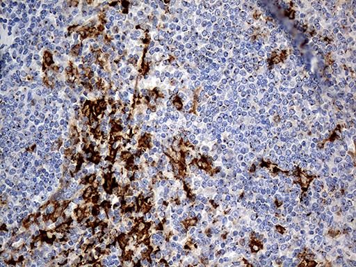 m00581 anti ptpn22 mouse monoclonal antibody clone id oti6b1 ihc testing 5