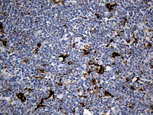 m00581 anti ptpn22 mouse monoclonal antibody clone id oti6b1 ihc testing 6