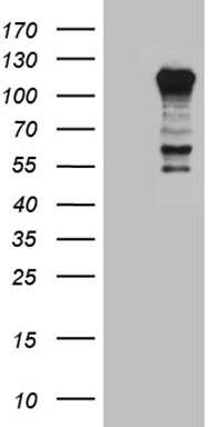 m00581 anti ptpn22 mouse monoclonal antibody clone id oti6b1 wb testing 1