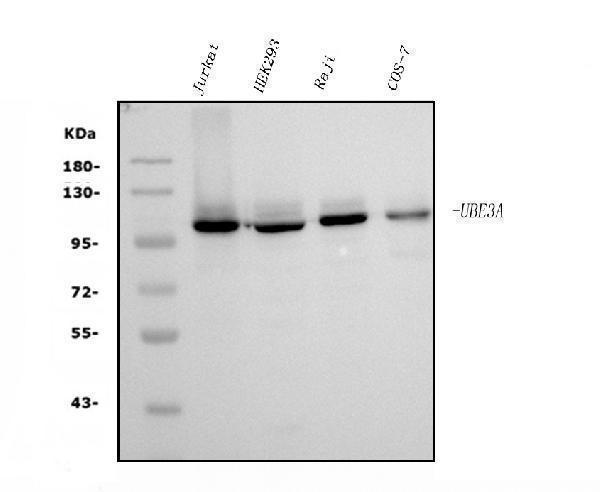  Western blot analysis of UBE3A using anti-UBE3A antibody (M00582-1)