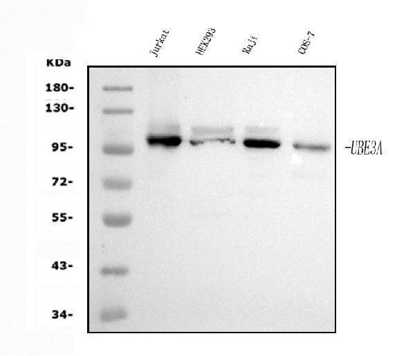  Western blot analysis of UBE3A using anti-UBE3A antibody (M00582-2)