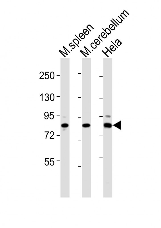 All lanes : Anti-Suz12 Antibody (Center) at 1:2000 dilutionLane 1: mouse spleen lysatesLane 2: mouse cerebellum lysatesLane 3: Hela whole cell lysatesLysates/proteins at 20 µg per lane