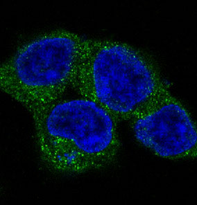 m00584 ulk1 primary antibodies if testing 3