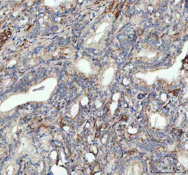 m00584 ulk1 primary antibodies ihc testing 2_1