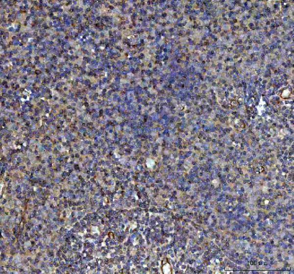 m00584 ulk1 primary antibodies ihc testing 3