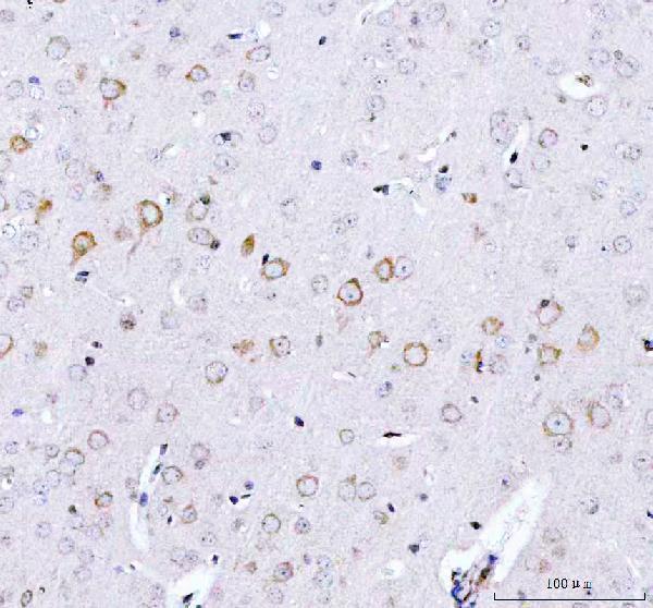 m00584 ulk1 primary antibodies ihc testing 4