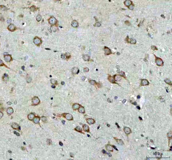 m00584 ulk1 primary antibodies ihc testing 5