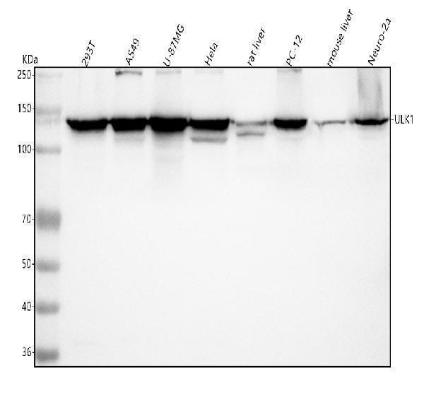 m00584 ulk1 primary antibodies wb testing 1
