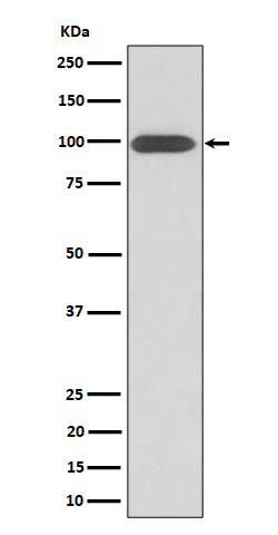 Western blot analysis of Integrin beta 3 / CD61 expression in U-87 MG cell lysate