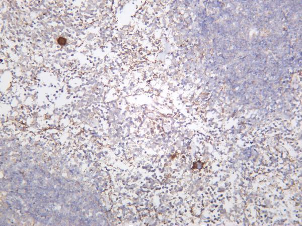 Mouse spleen was stained with anti-Integrin β3 rabbit antibody