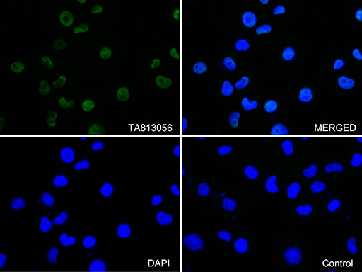 Immunofluorescent staining of NCI-H1299 cells using anti-EWSR1 antibody (M00589-1/green
