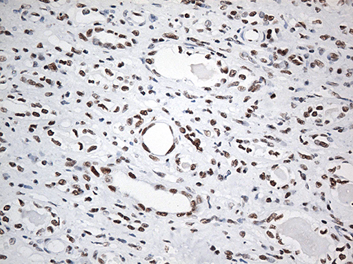 Immunohistochemical staining of paraffin-embedded Human Kidney tissue within the normal limits using anti-EWSR1 mouse monoclonal antibody
