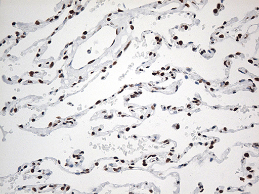 m00589 1 anti ewsr1 mouse monoclonal antibody clone id oti3f6 ihc testing 12
