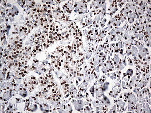 m00589 1 anti ewsr1 mouse monoclonal antibody clone id oti3f6 ihc testing 3