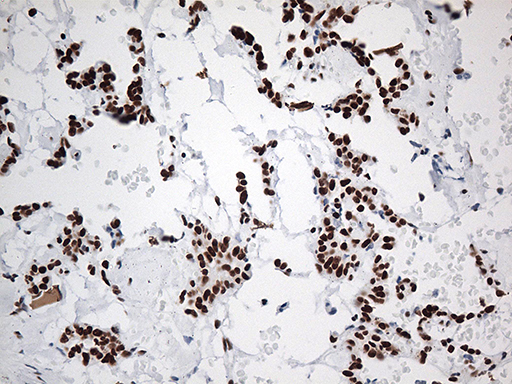 m00589 1 anti ewsr1 mouse monoclonal antibody clone id oti3f6 ihc testing 4