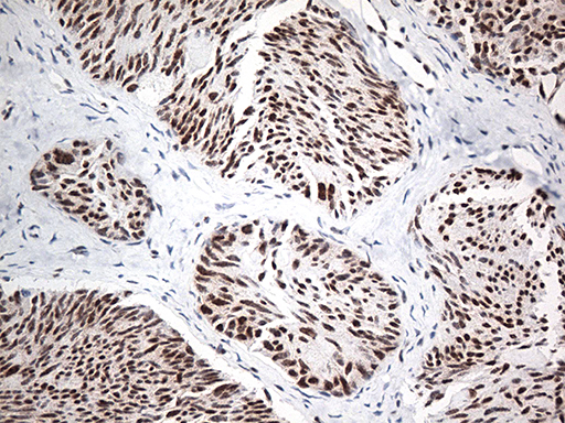 m00589 1 anti ewsr1 mouse monoclonal antibody clone id oti3f6 ihc testing 5