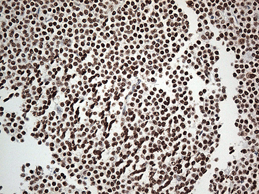 m00589 1 anti ewsr1 mouse monoclonal antibody clone id oti3f6 ihc testing 6