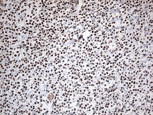 m00589 1 anti ewsr1 mouse monoclonal antibody clone id oti3f6 ihc testing 7