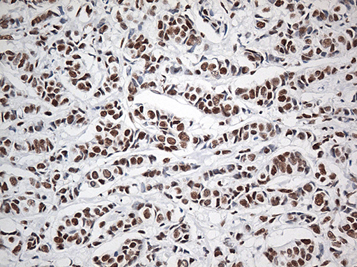 m00589 1 anti ewsr1 mouse monoclonal antibody clone id oti3f6 ihc testing 8