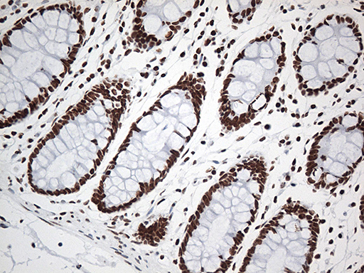m00589 1 anti ewsr1 mouse monoclonal antibody clone id oti3f6 ihc testing 9