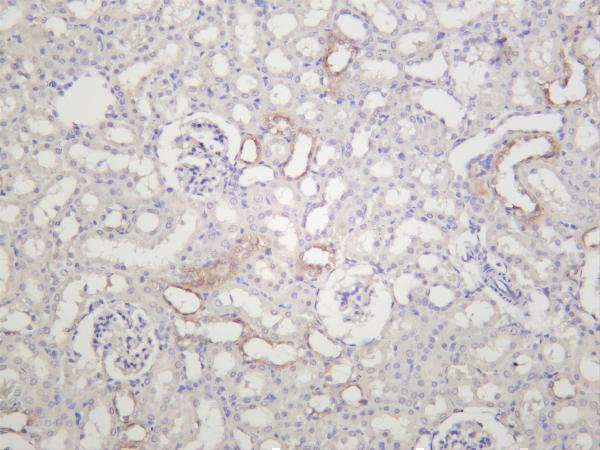 m00591 4 tfrc primary antibodies ihc testing 4