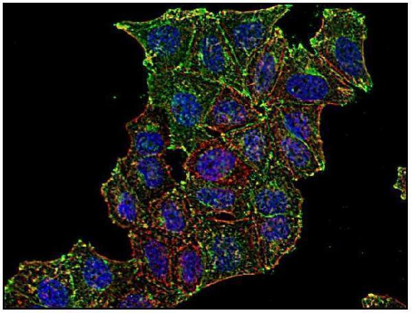 m00591 hu cd71 primary antibodies icc testing 1