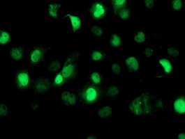 m00592 1 anti samhd1 mouse monoclonal antibody clone id oti1a1 if testing 16