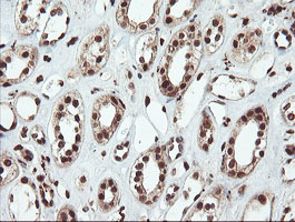 m00592 1 anti samhd1 mouse monoclonal antibody clone id oti1a1 ihc testing 10