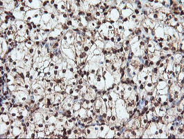 m00592 1 anti samhd1 mouse monoclonal antibody clone id oti1a1 ihc testing 11