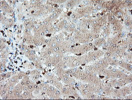 m00592 1 anti samhd1 mouse monoclonal antibody clone id oti1a1 ihc testing 12