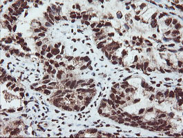 m00592 1 anti samhd1 mouse monoclonal antibody clone id oti1a1 ihc testing 4