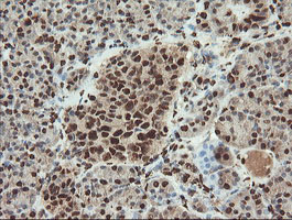m00592 1 anti samhd1 mouse monoclonal antibody clone id oti1a1 ihc testing 5