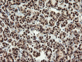 m00592 1 anti samhd1 mouse monoclonal antibody clone id oti1a1 ihc testing 6