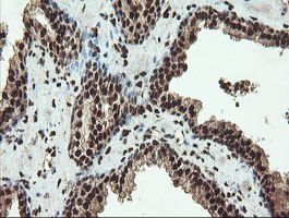 m00592 1 anti samhd1 mouse monoclonal antibody clone id oti1a1 ihc testing 7